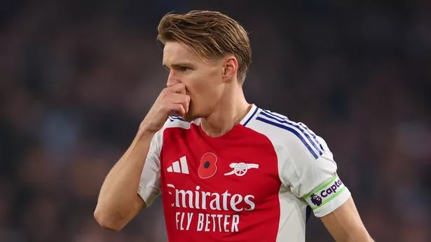 Martin Odegaard’s true injury hidden from public as Arsenal took drastic measures