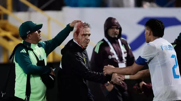 Mexico manager left bloody after beer can hit him on head accused of causing it himself