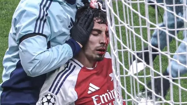 Mikel Arteta offers update after Kai Havertz left pouring with blood from head injury