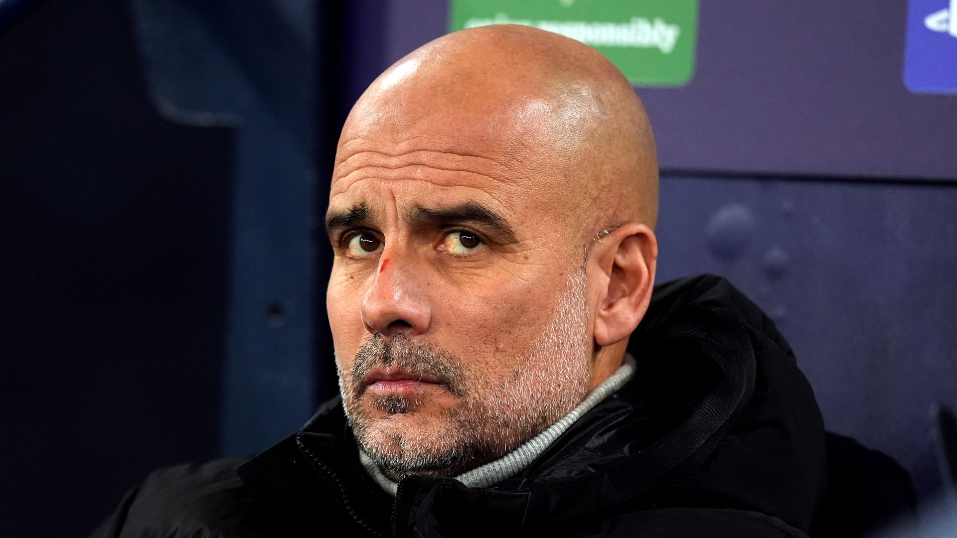 Guardiola clarifies comments over scratches on face and head