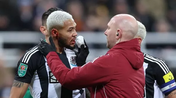 Newcastle star Joelinton rushed to hospital with ‘nasty’ bloodied ear injury
