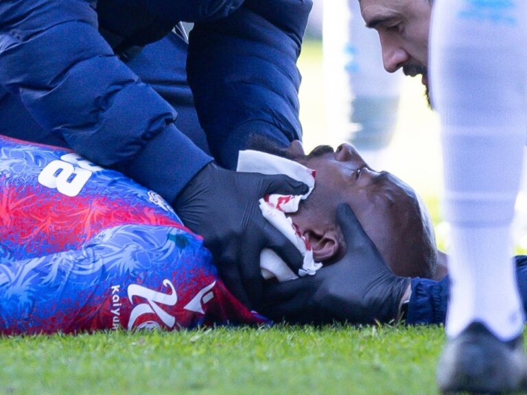 Jean-Philippe Mateta: Crystal Palace star issues injury update after his ear was “destroyed” by Liam Roberts challenge