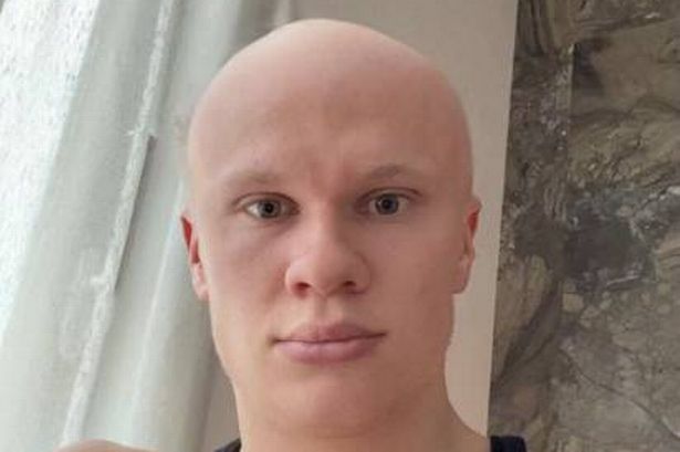 Erling Haaland ‘goes bald’ as Man City star tests out radical new look